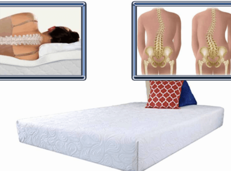 best mattress for slight scoliosis