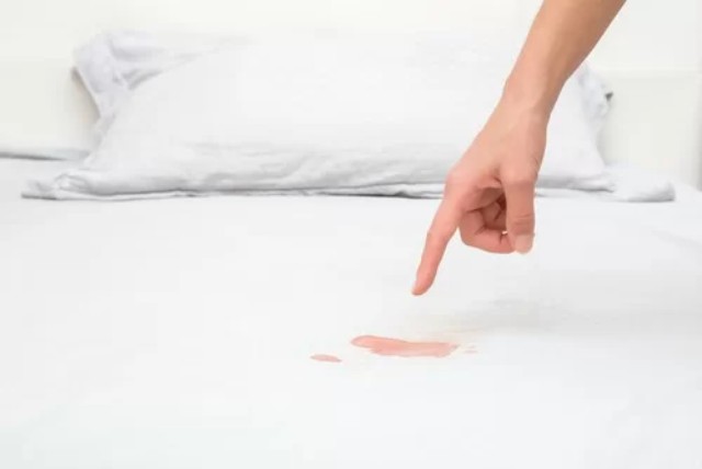 Removing Blood Stains From Mattresses