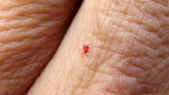 How To Get Rid Of Chiggers In Mattresses