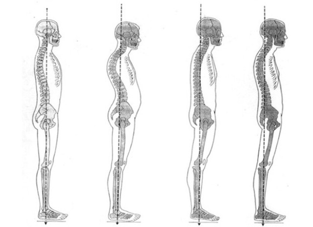 Spinal Alignment